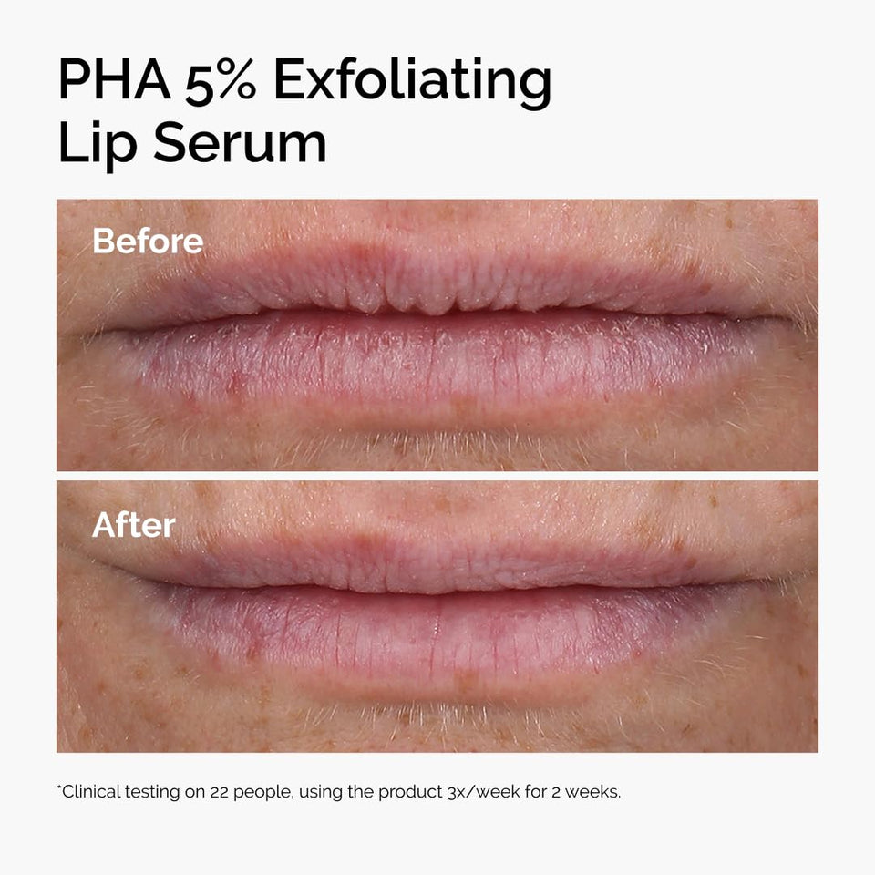 PHA 5% Exfoliating Lip Serum
